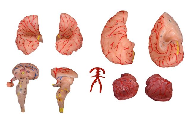 Brain with Arteries 9 Parts - Image 2
